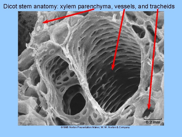 Dicot stem anatomy: xylem parenchyma, vessels, and tracheids © 1996 Norton Presentation Maker, W.