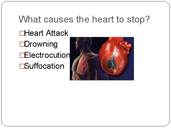 What causes the heart to stop? �Heart Attack �Drowning �Electrocution �Suffocation 