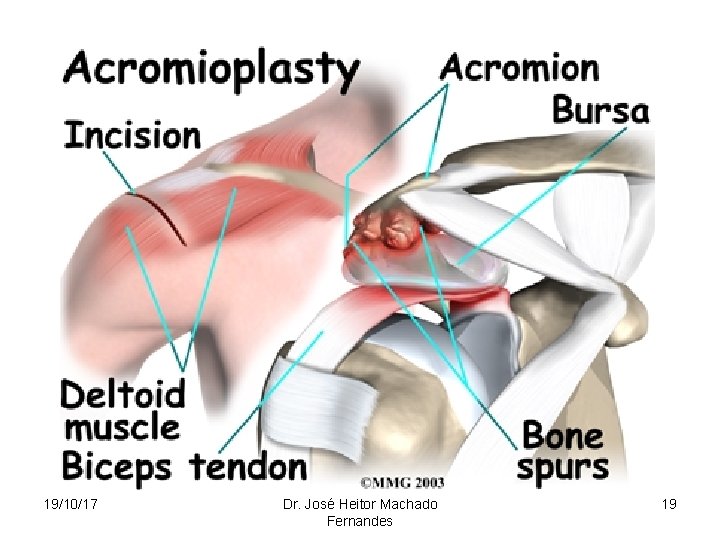 19/10/17 Dr. José Heitor Machado Fernandes 19 