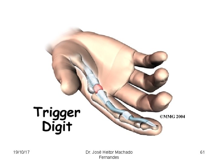 19/10/17 Dr. José Heitor Machado Fernandes 61 