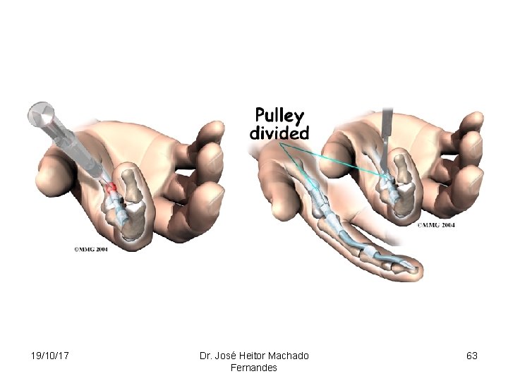 19/10/17 Dr. José Heitor Machado Fernandes 63 