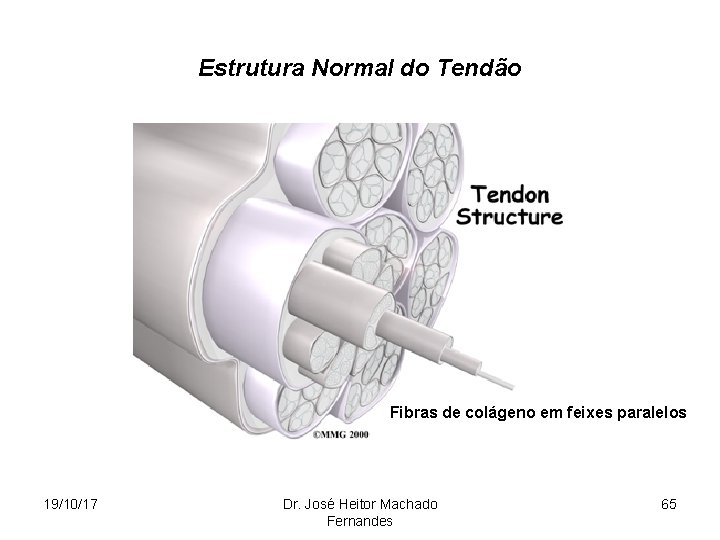 Estrutura Normal do Tendão Fibras de colágeno em feixes paralelos 19/10/17 Dr. José Heitor