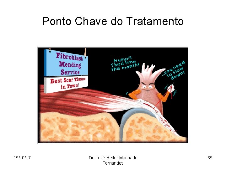 Ponto Chave do Tratamento 19/10/17 Dr. José Heitor Machado Fernandes 69 