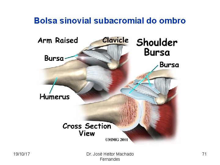 Bolsa sinovial subacromial do ombro 19/10/17 Dr. José Heitor Machado Fernandes 71 