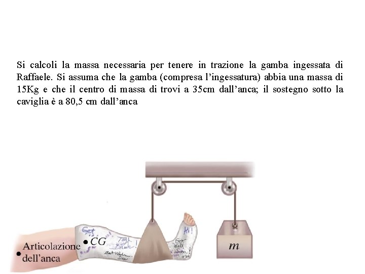 Si calcoli la massa necessaria per tenere in trazione la gamba ingessata di Raffaele.
