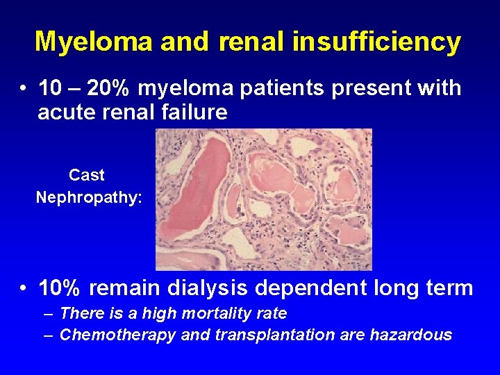 Myeloma and renal insufficiency • 10 – 20% myeloma patients present with acute renal
