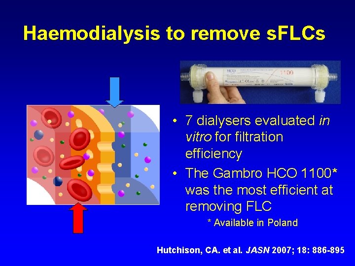 Haemodialysis to remove s. FLCs • 7 dialysers evaluated in vitro for filtration efficiency