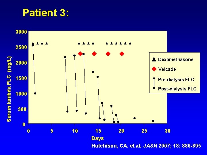 Patient 3: 3000 Serum lambda FLC (mg/L) 2500 Dexamethasone 2000 Velcade 1500 Pre-dialysis FLC
