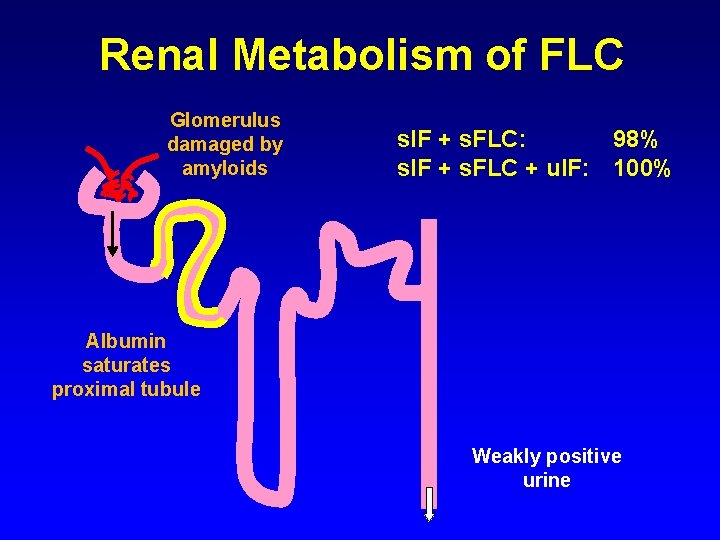 Renal Metabolism of FLC Glomerulus damaged by amyloids s. IF + s. FLC: 98%
