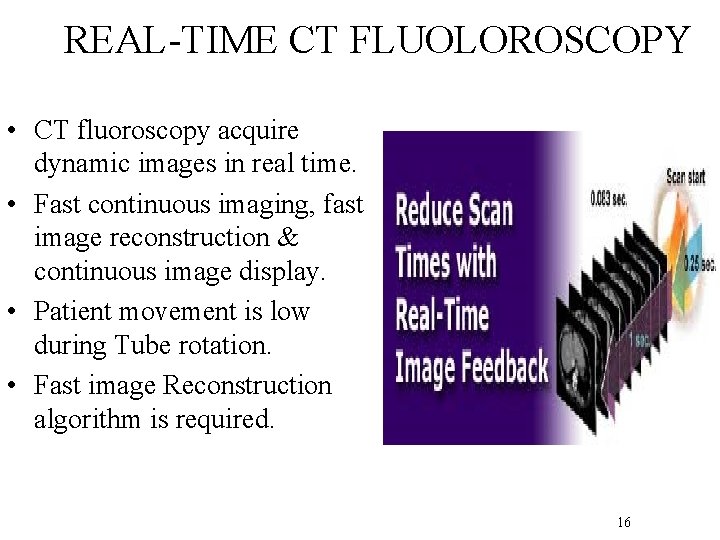 REAL-TIME CT FLUOLOROSCOPY • CT fluoroscopy acquire dynamic images in real time. • Fast