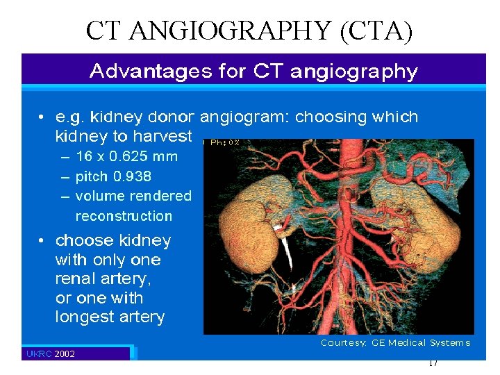 CT ANGIOGRAPHY (CTA) 17 