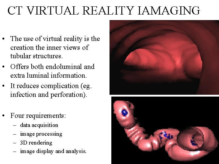 CT VIRTUAL REALITY IAMAGING • The use of virtual reality is the creation the