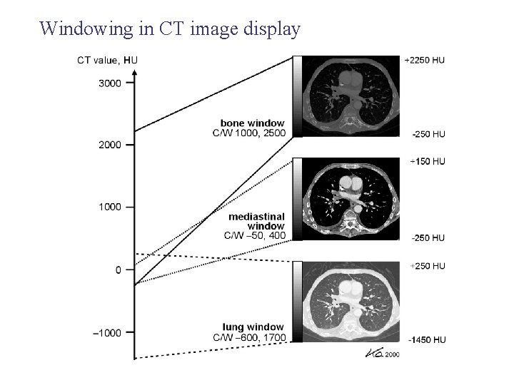 Windowing in CT image display 