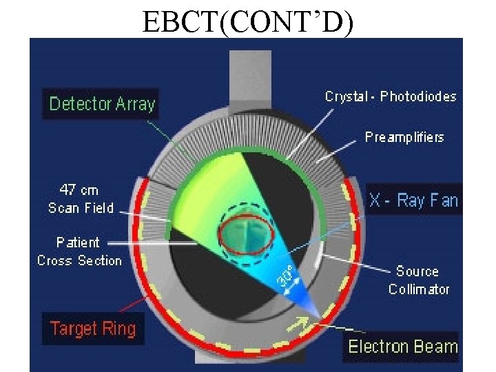 EBCT(CONT’D) 9 