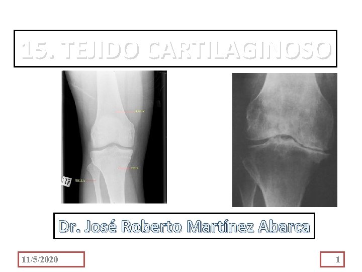 15. TEJIDO CARTILAGINOSO Dr. José Roberto Martínez Abarca 11/5/2020 1 
