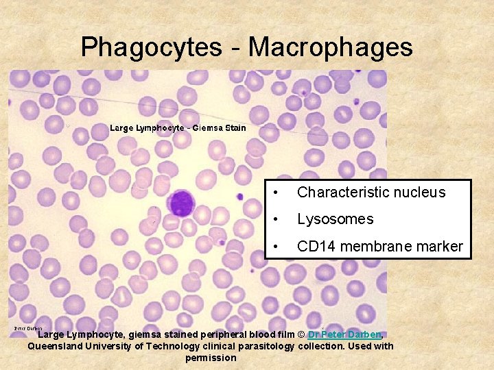 Phagocytes - Macrophages • Characteristic nucleus • Lysosomes • CD 14 membrane marker Large