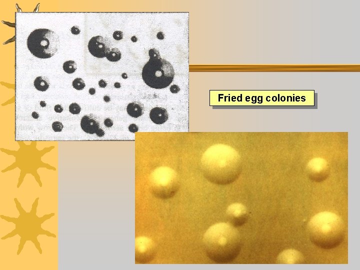 Fried egg colonies Dr Ekta, Microbiology, GMCA 