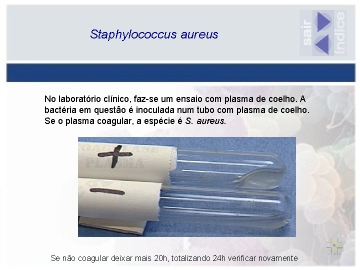 Staphylococcus aureus No laboratório clínico, faz-se um ensaio com plasma de coelho. A bactéria