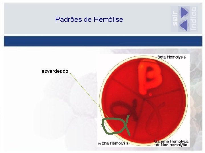 Padrões de Hemólise esverdeado 