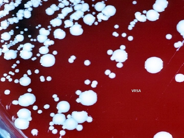 VRSA 