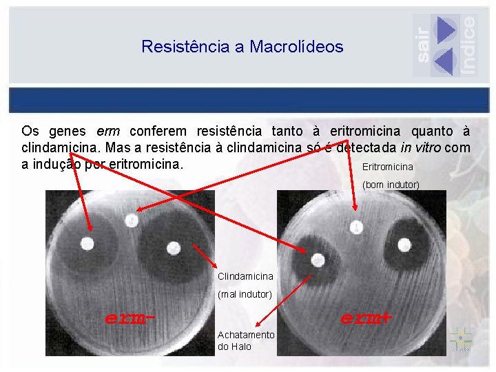 Resistência a Macrolídeos Os genes erm conferem resistência tanto à eritromicina quanto à clindamicina.