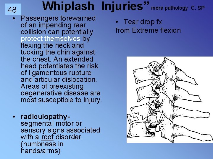 48 Whiplash Injuries” more pathology C. SP • Passengers forewarned of an impending rear