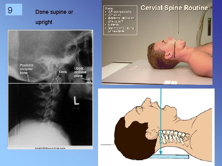 9 Done supine or upright 