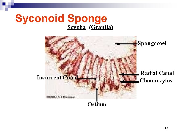 Syconoid Sponge Scypha (Grantia) Spongocoel Radial Canal Choanocytes Incurrent Canal Ostium 15 
