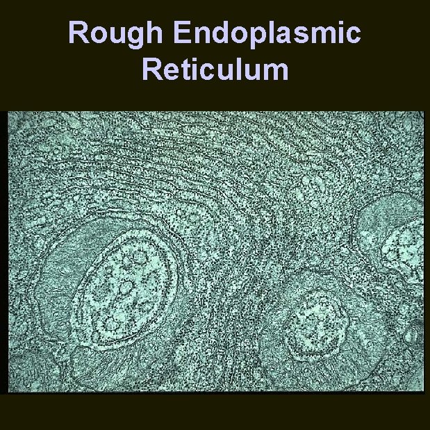 Rough Endoplasmic Reticulum 