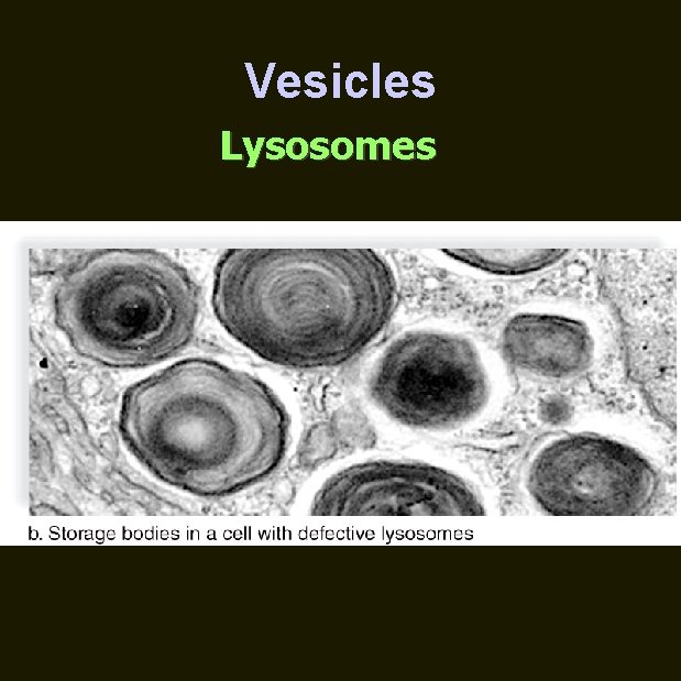 Vesicles Lysosomes 