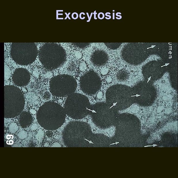 Exocytosis 