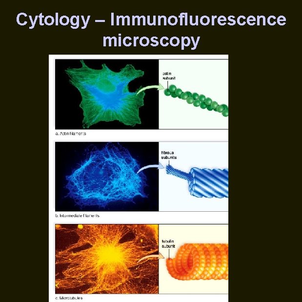 Cytology – Immunofluorescence microscopy 