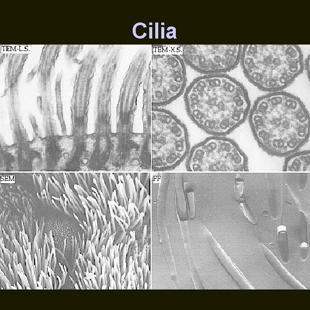 Cilia 