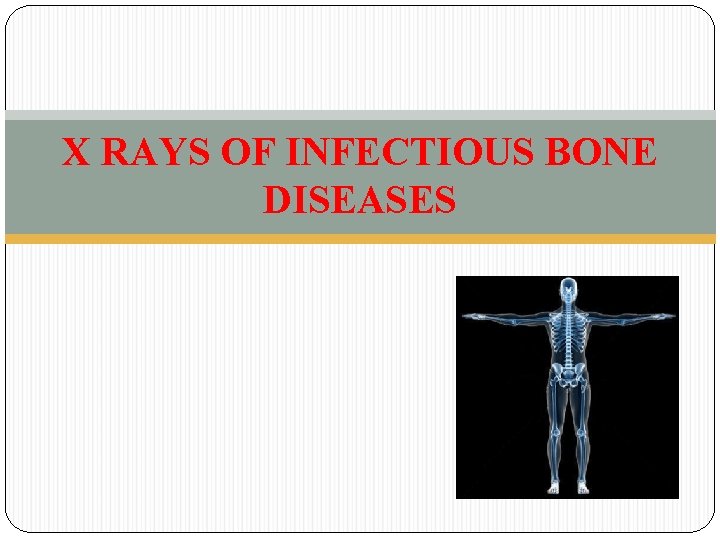 X RAYS OF INFECTIOUS BONE DISEASES 