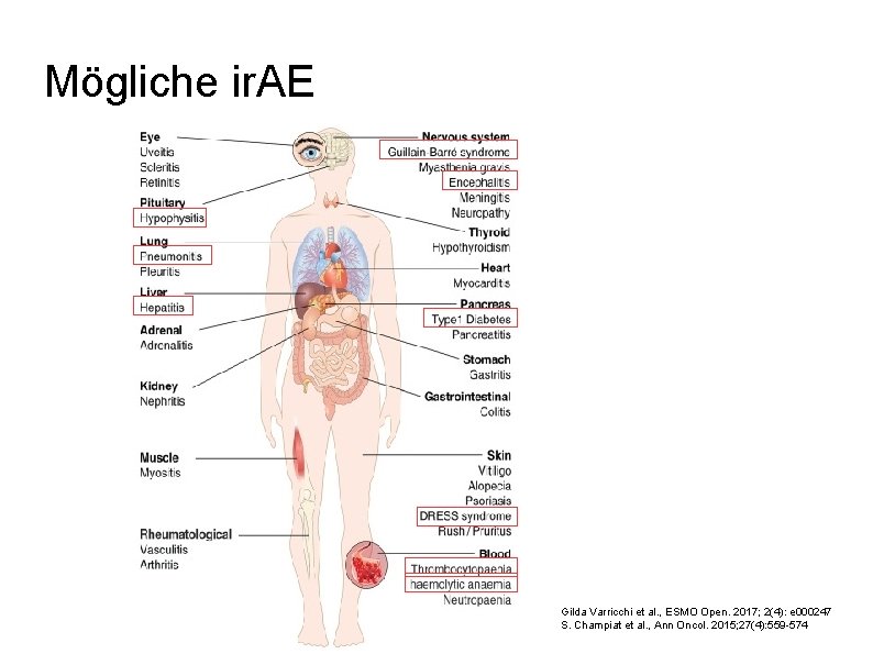 Mögliche ir. AE Gilda Varricchi et al. , ESMO Open. 2017; 2(4): e 000247