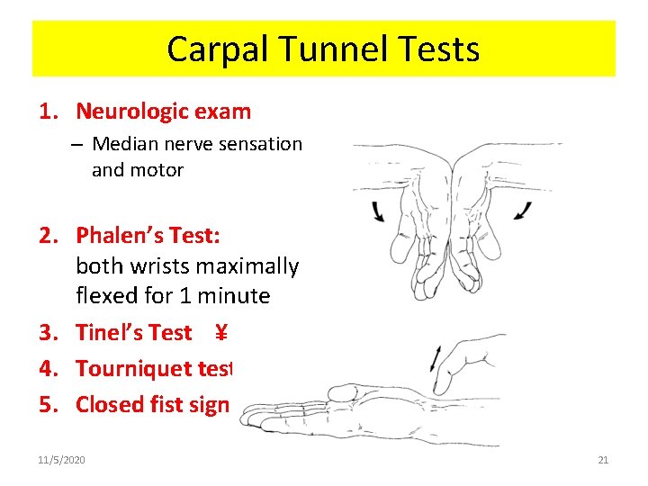 Carpal Tunnel Tests 1. Neurologic exam – Median nerve sensation and motor 2. Phalen’s