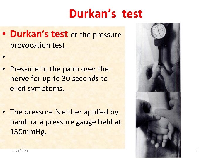 Durkan’s test • Durkan’s test or the pressure provocation test • • Pressure to