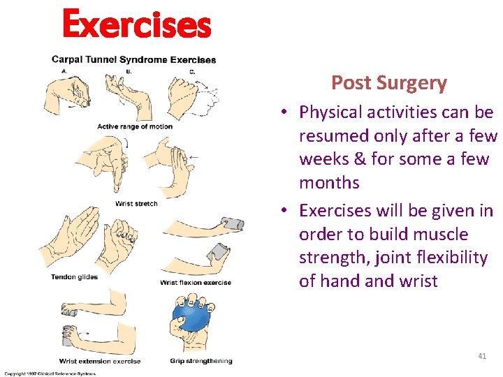 Exercises Post Surgery • Physical activities can be resumed only after a few weeks
