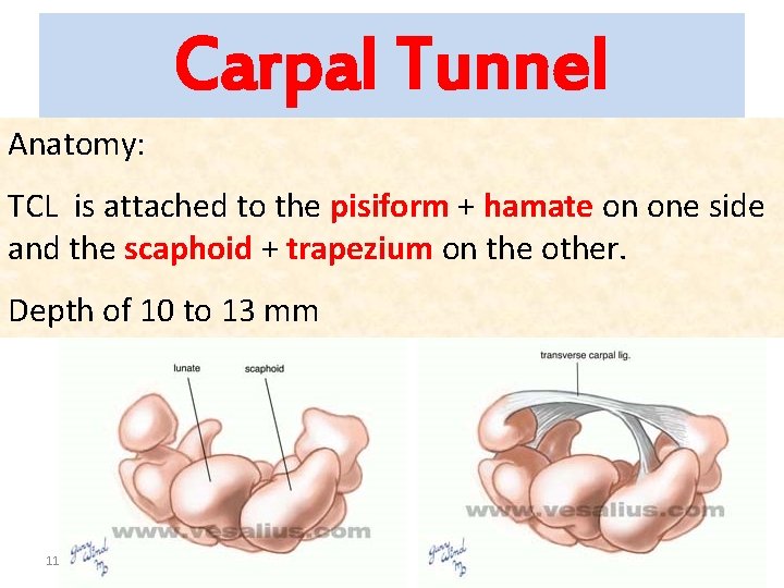 Carpal Tunnel Anatomy: TCL is attached to the pisiform + hamate on one side