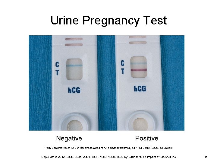Urine Pregnancy Test From Bonewit-West K: Clinical procedures for medical assistants, ed 7, St