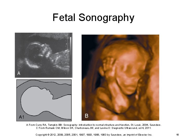 Fetal Sonography A From Curry RA, Tempkin BB: Sonography: introduction to normal structure and