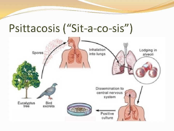 Psittacosis (“Sit-a-co-sis”) 