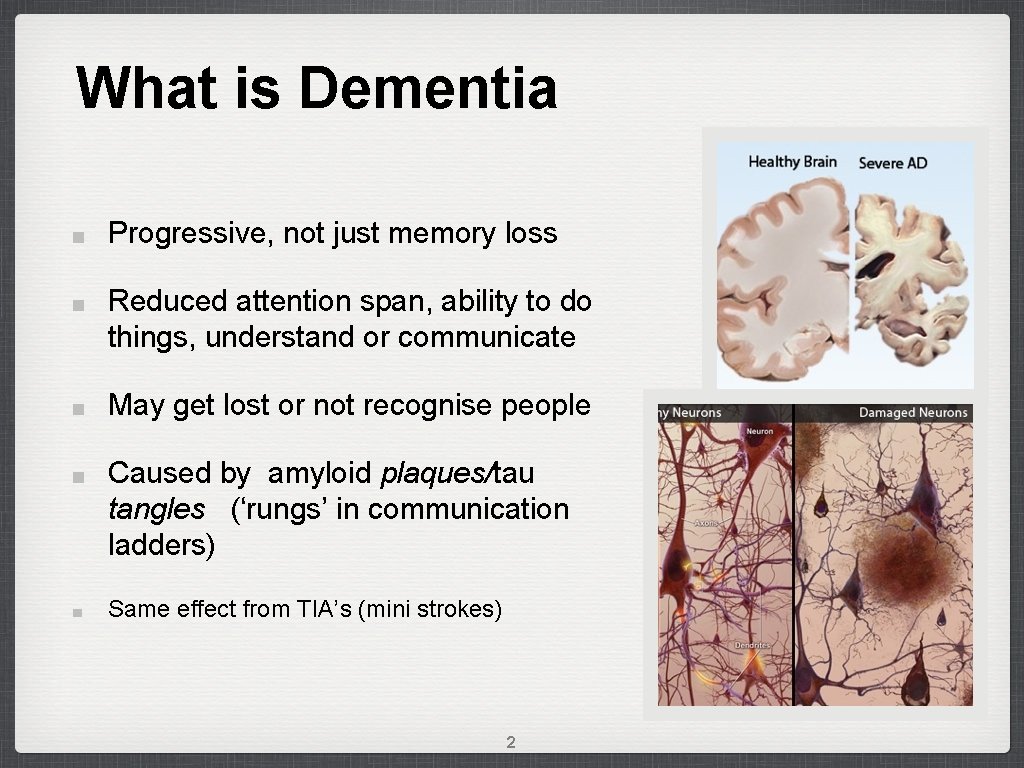 What is Dementia Progressive, not just memory loss Reduced attention span, ability to do
