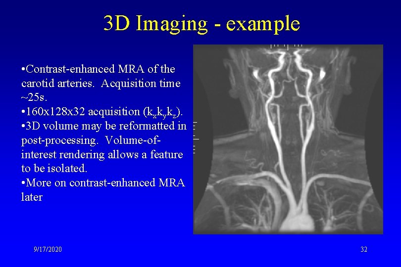 3 D Imaging - example • Contrast-enhanced MRA of the carotid arteries. Acquisition time