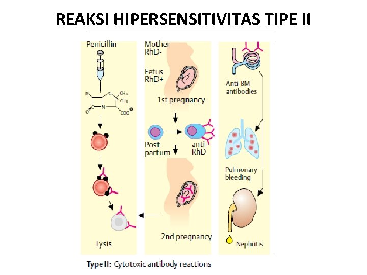 REAKSI HIPERSENSITIVITAS TIPE II 