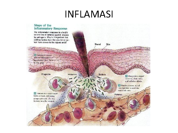 INFLAMASI 
