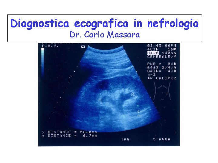 Diagnostica ecografica in nefrologia Dr. Carlo Massara 