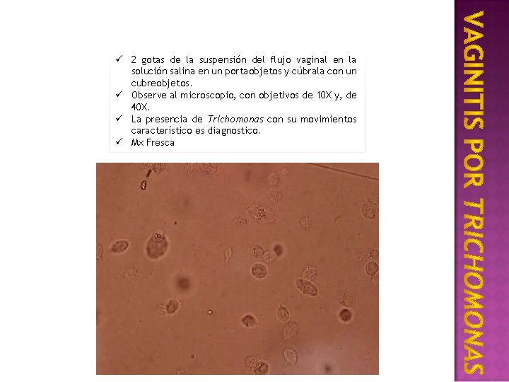 ü 2 gotas de la suspensión del flujo vaginal en la solución salina en