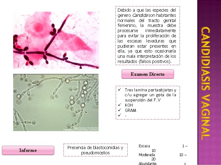 Debido a que las especies del genero Candida son habitantes normales del tracto genital