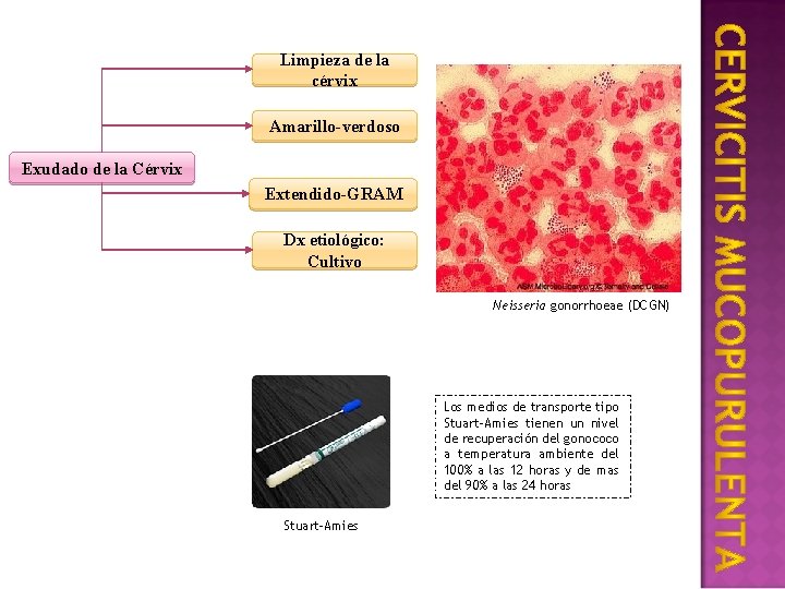 Limpieza de la cérvix Amarillo-verdoso Exudado de la Cérvix Extendido-GRAM Dx etiológico: Cultivo Neisseria